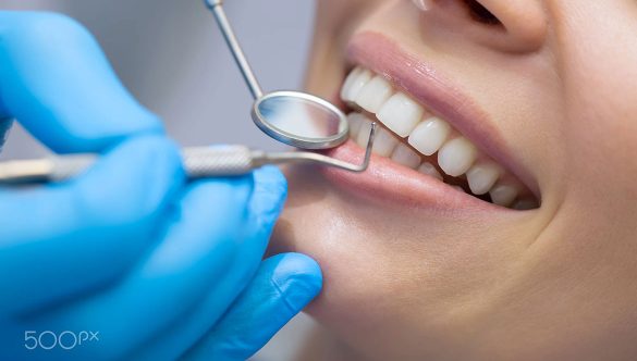 Traitement Orthodontique