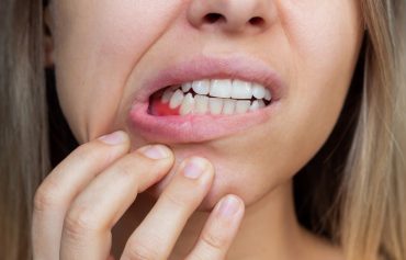 Maladies De La Bouche