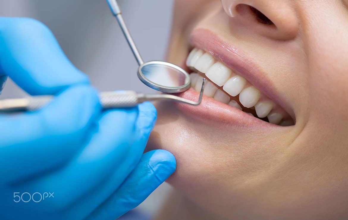 Traitement Orthodontique