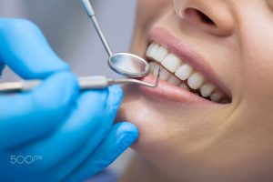 Traitement Orthodontique