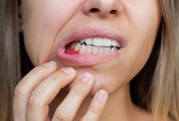 Maladies De La Bouche
