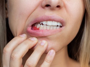 Maladies De La Bouche