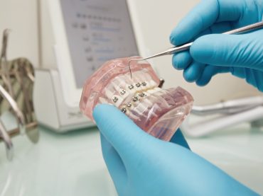 Orthodontiste