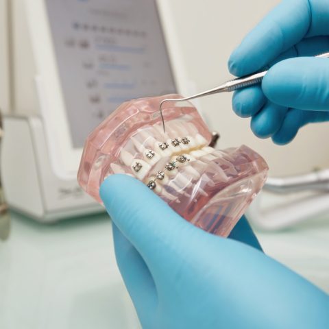 Orthodontiste